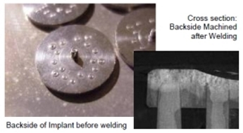 Fig. 8 - Medical Implant